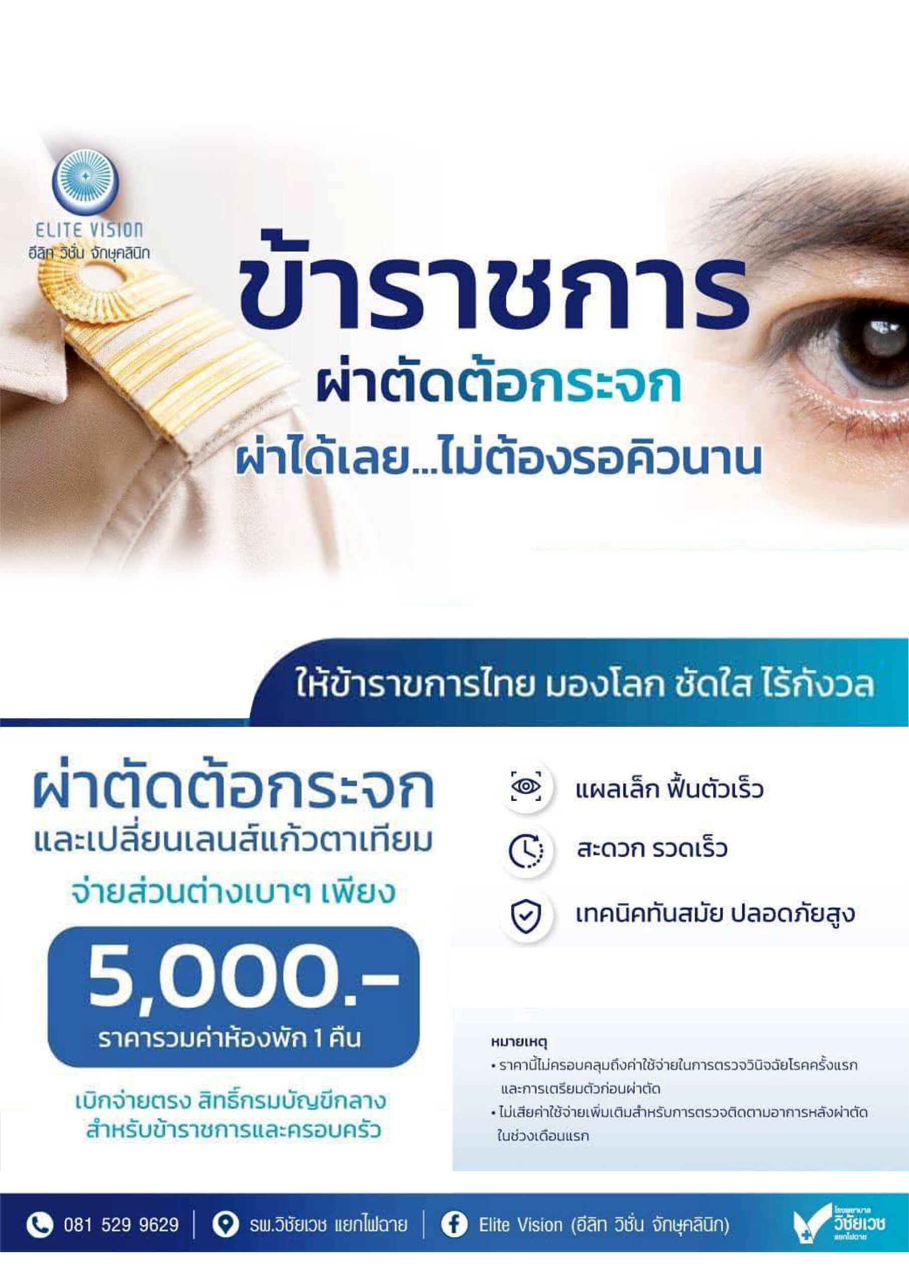 โปรแกรมผ่าตัดต้อกระจก สิทธิข้าราชการ Elite Vision